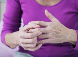 How to Prevent Arthritis in 10 Different Ways