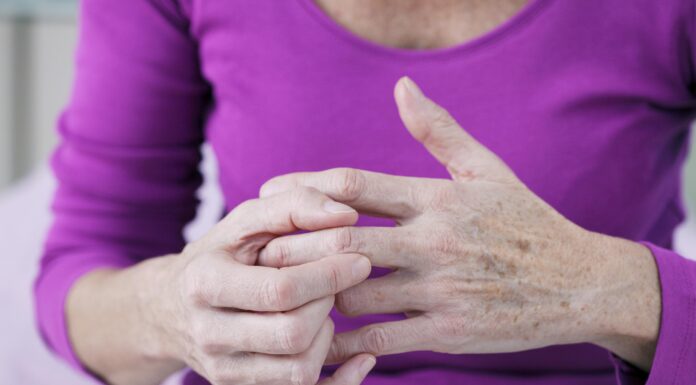 How to Prevent Arthritis in 10 Different Ways