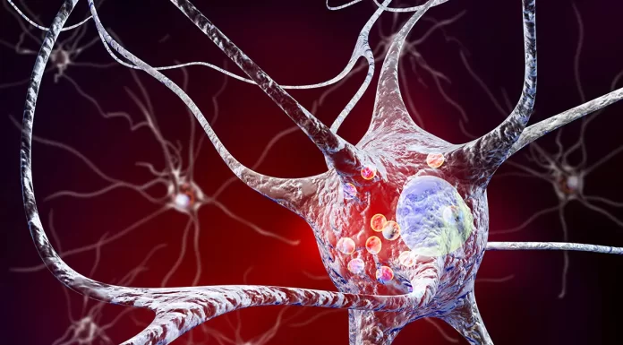 Detecting Parkinson’s Disease Early