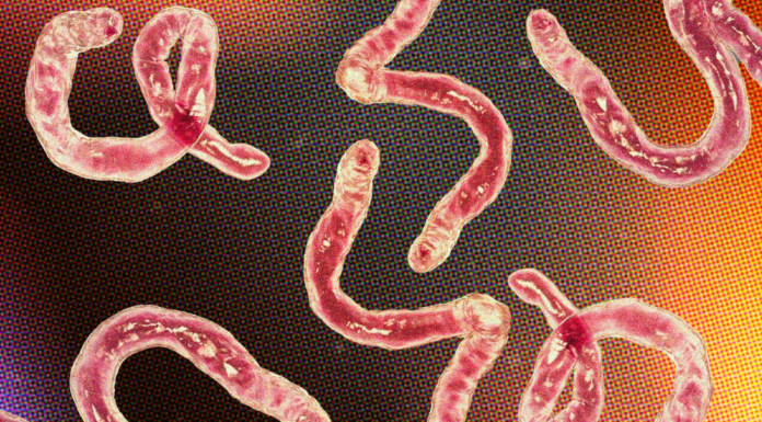 Parasite Purge: Cleansing Your Body for Optimal Health